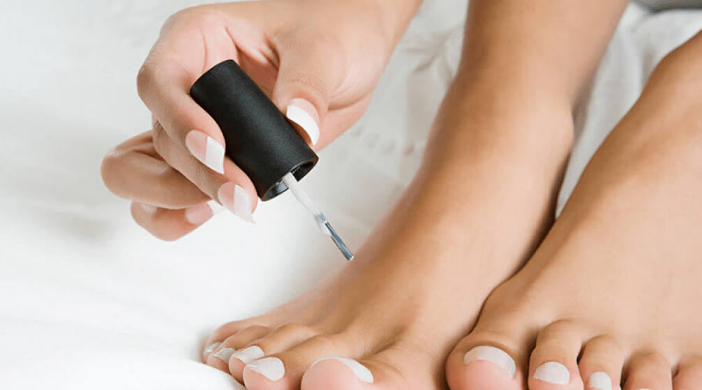 treatment of fungus on the thumb with nail polish
