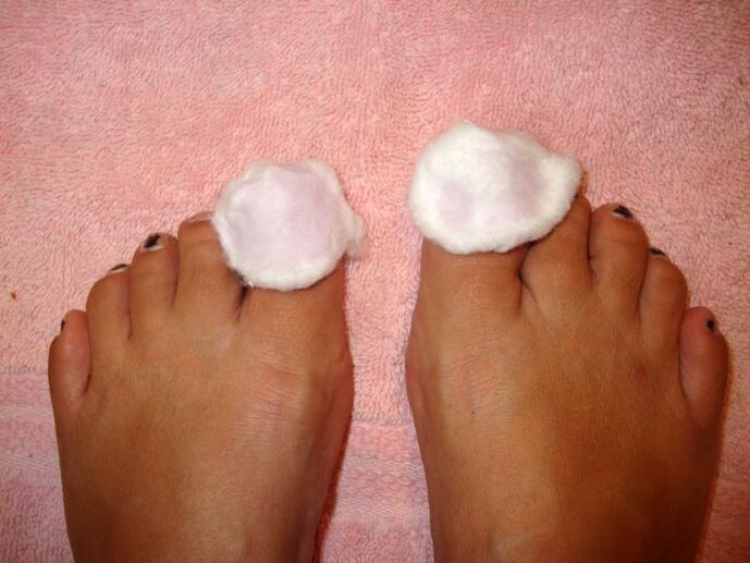 lotions for fungus on the feet