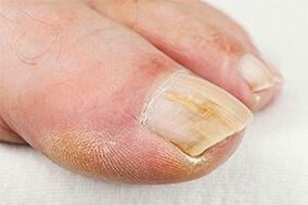 Ground -finger