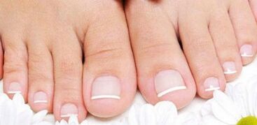 Prevention of the appearance of the fungus on the nails of the legs