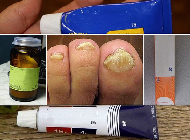 General principles for the treatment of fungus