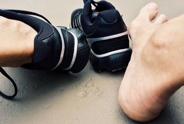 The causes of the appearance of mycosis of the legs