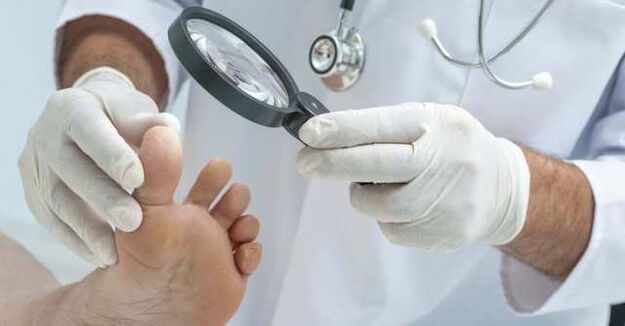 examination of feet for fungal infection