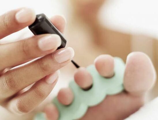 treating nails with nail polish for a fungal infection