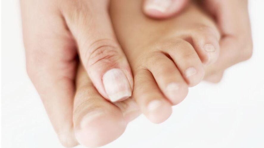 itching due to nail fungus on the big toe