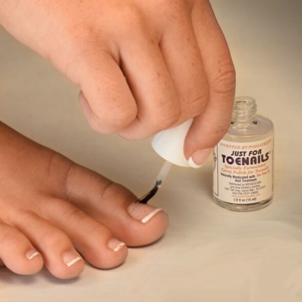 fungus varnish is used in the early stages of nail fungus infection